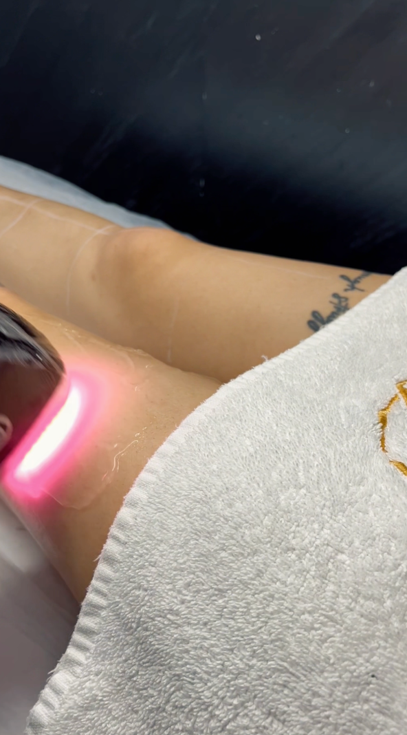 diode lazer epilasyon sultangazi video